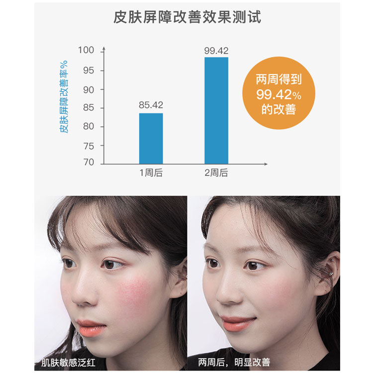 神经酰胺乳液敏感肌修复面霜正品高补水保湿滋润控油清爽 RNW 韩国 神经酰胺乳液敏感肌修复面霜正品高补水保湿滋润控油清爽 RNW 韩国