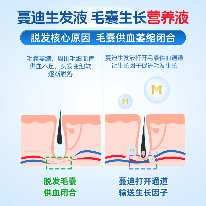 蔓迪米诺地尔酊防脱育发液生发液增发液密发男女性曼迪 - 图1