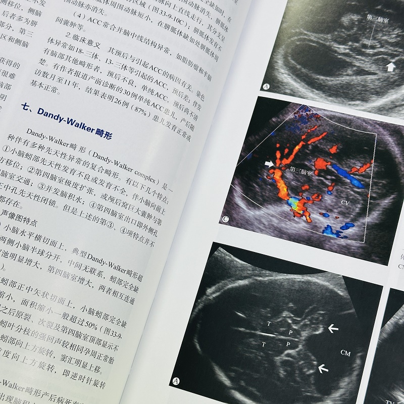 【官方现货】24年新版 超声医学第七版7版 唐杰 郭万学 科学出版社 正版超声医师专业书参考工具书超声医学基础诊断超声治疗 - 图2