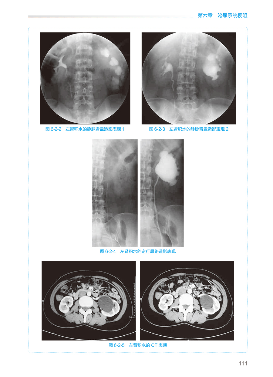 外科学泌尿外科分册第2版周利群王行环国家卫生健康委员会住院医师规范化培训规划教材住培考典人民卫生出版社9787117343329-图2