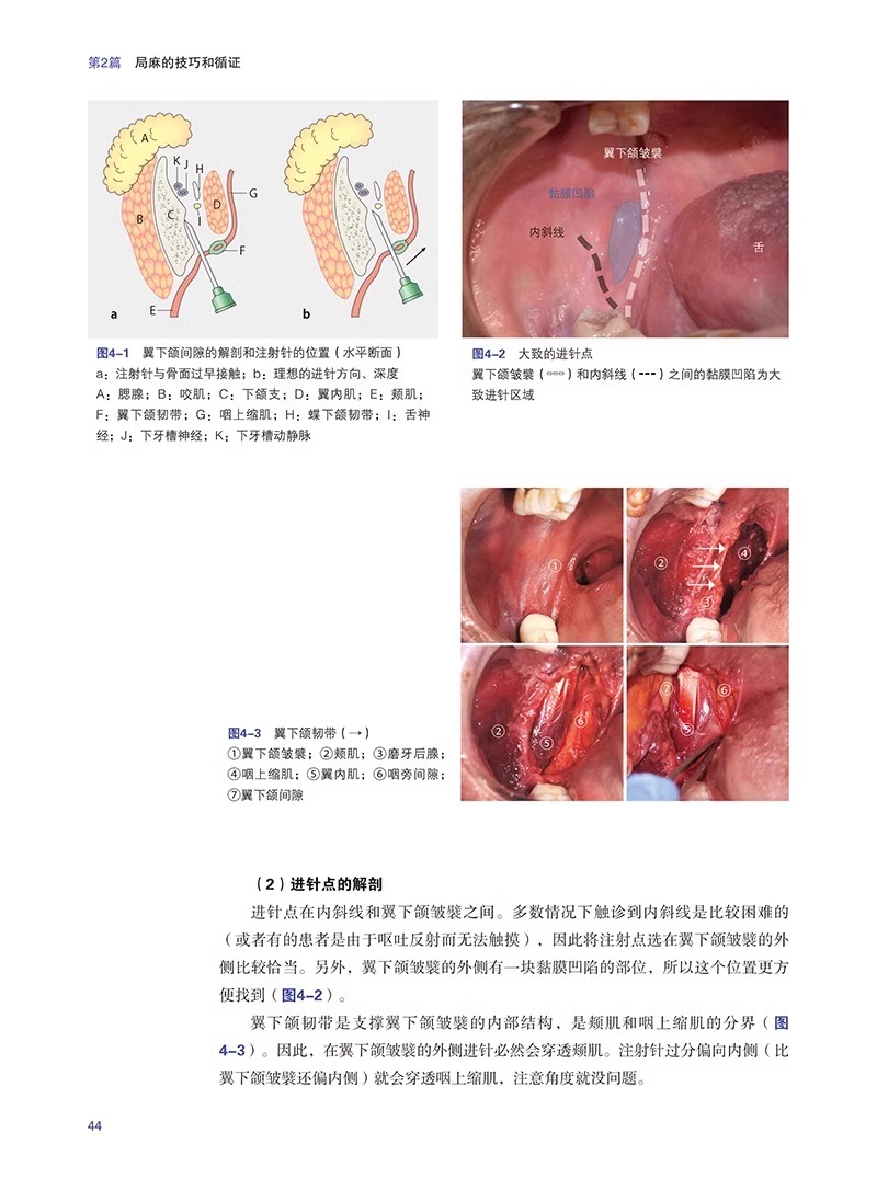 口腔临床麻醉技术与技巧 基于循证和解剖 岩永让等编 牙科学书籍 拔牙麻醉口腔临床医学书籍 辽宁科学技术出版社9787559132246 - 图3