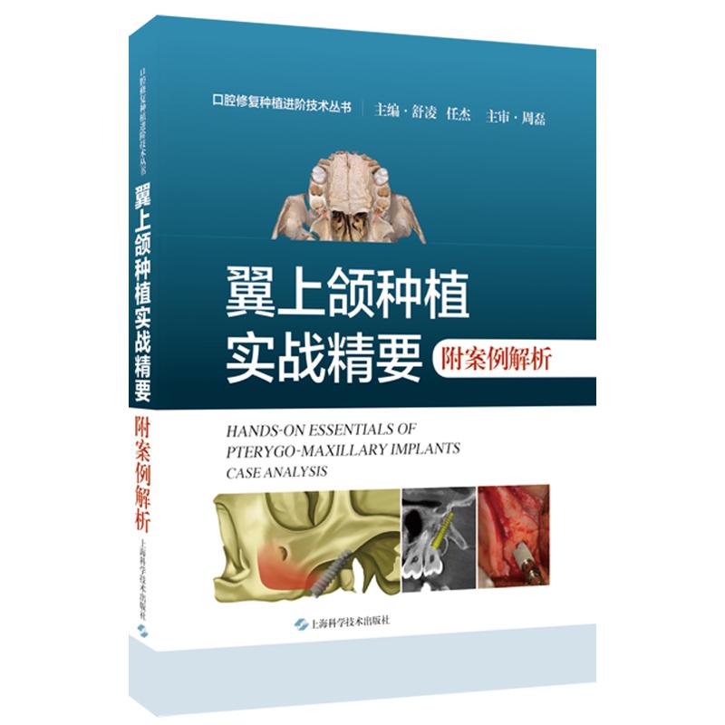 翼上颌种植实战精要附案例解析 舒凌 任杰 适合口腔种植科医师阅读 上颌磨牙区垂直骨高度不足 上海科学技术出版社 9787547865705