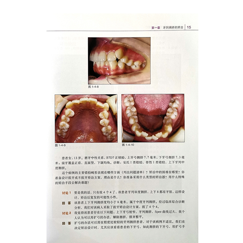 口腔正畸思路与临床操作技巧 口腔正畸学入门书籍教材 武广增主编 牙医医学书籍 科学技术文献出版社9787502364793 口腔正琦学 - 图3