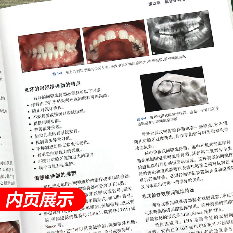 正版 儿童口腔早期矫治 翻译版 口腔正畸修复种植医学专科教程书籍儿牙口腔牙齿形态重塑咬合诱导当代牙病治疗技术 人民卫生出版社