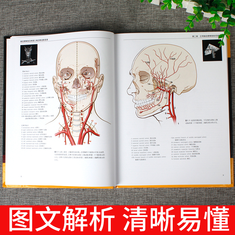 正版脑血管解剖及病理三维血管造影图谱人体脑血管解剖学图谱神经外科医生技术参考书颈部颅内动脉静脉医学书脑血管解剖图谱-图1