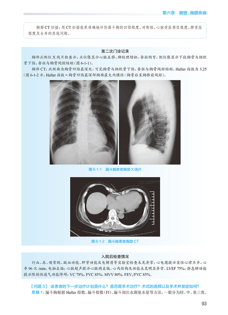 正版 外科学 胸心外科分册 第2版 胡盛寿 王俊主编 国家卫生健康委员会住院医师规范化培训规划教材 人民卫生出版社9787117343046 - 图2