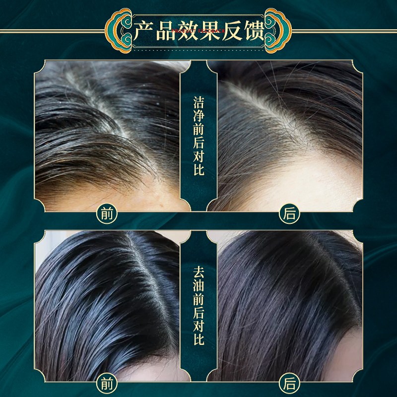 佰珍堂生姜香味持久留香控油洗发水 佰珍堂洗发水