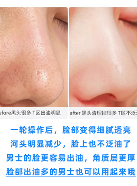 科颜氏深层清洁去黑头面膜