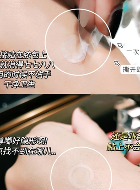 戳客服31vt老虎痘痘贴