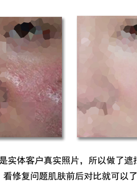 去除敏感肌肤角质层修复面膜粉
