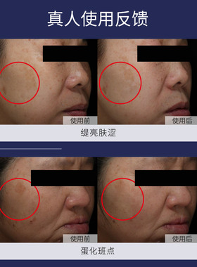 肌肤未来美白淡斑任何肤质提亮