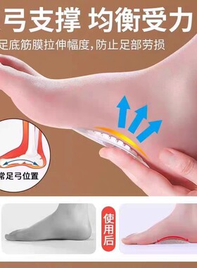 现货硅胶条纹足弓垫男女足弓支撑垫扁平足鞋垫儿童成人按摩脚心垫