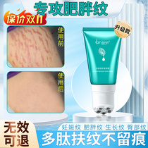 Obese tattox removing male elimination thigh growth tattox to obese tattox students to dispel down tummy repair cream body milk