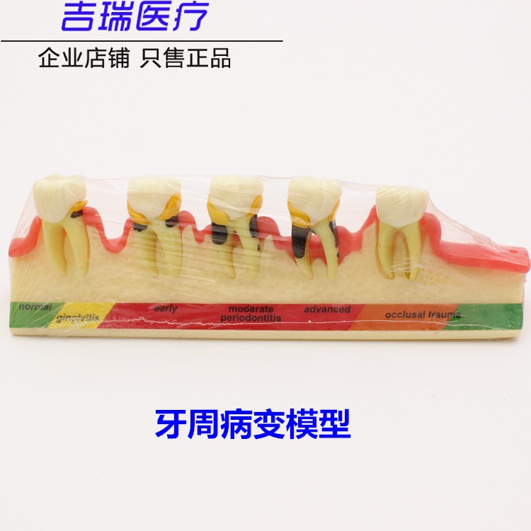 牙齿模型口腔教学正畸种植修复模型可拆卸假牙备牙模型雕石膏牙科-图1