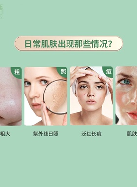 南非欧卡尔Alcare aloe深度保湿日霜补水消痘祛印改善暗沉修护