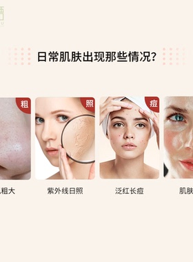 南非欧卡尔Alcare aloe深度保湿晚霜补水消痘祛印改善暗沉修护