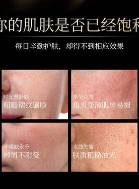 英国进口查理铂肌补水保湿精华乳