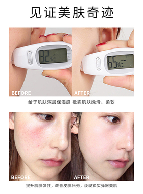 菲必丽童颜面膜补水提亮修护