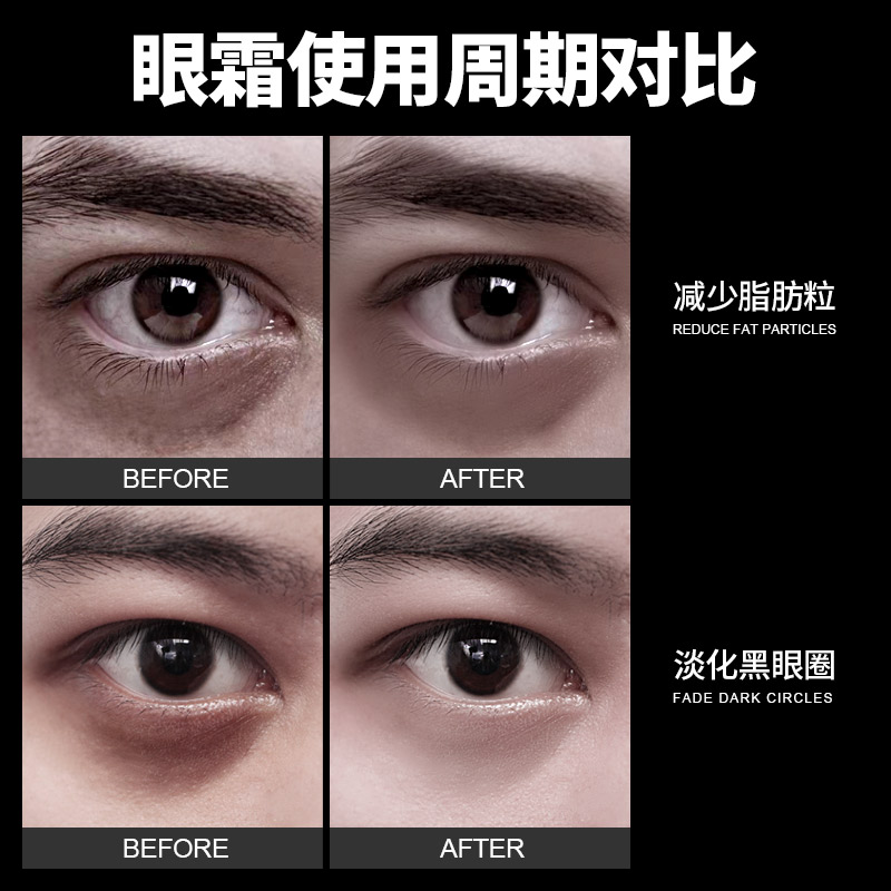 罗杰夫化妆品旗舰店罗杰夫男士眼霜去黑眼圈男士专用去眼袋淡化细纹抗皱补水保湿学生1