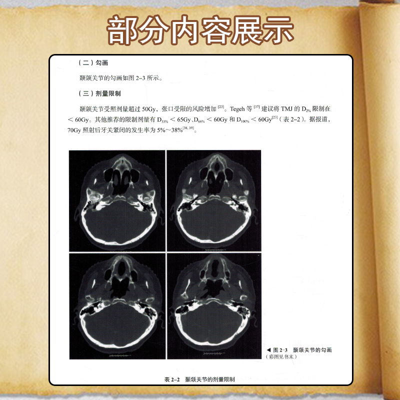 现货正版放射肿瘤学急性与晚期毒性的防治放射肿瘤学中的毒性管理9787504691002-图2