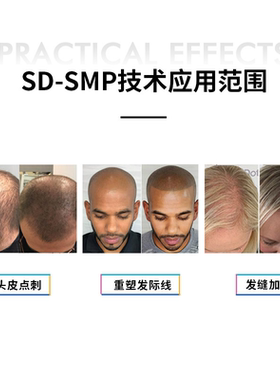 纹发仪器毛囊渲染术SMP头皮微色素沉着打印式纹发脉冲仪精密出针