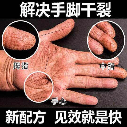 Horse oil hand and foot dry, rough, chapped and peeling horse oil cream hand cream anti-crack and antifreeze cream winter hand protection