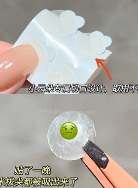 【品牌直供】盾施美痘痘贴
