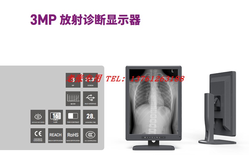 康冠KTC 艺卓EIZO医疗显示器 21寸标屏放射诊断2MP 3MP 4MP灰阶 - 图2