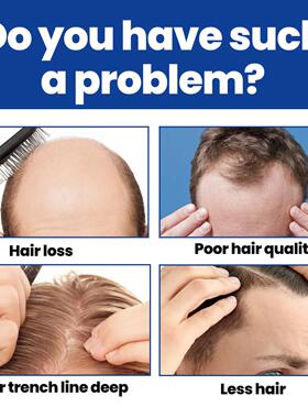 East Moon Men's Hair Care Foam - Enriching Nutrient Solution