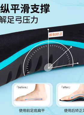 足弓支撑扁平足专用矫正鞋垫女士足弓垫男高足弓调整脚垫足弓鞋垫
