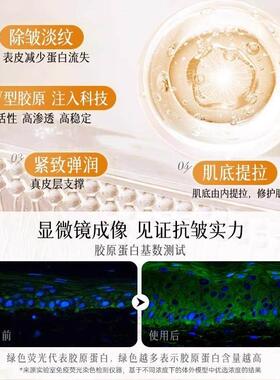 【韩国明星同款】玻尿酸钠抗皱睡眠纹贴细纹法令纹抗皱贴正品