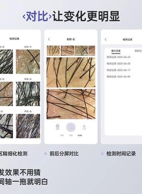 高档Mriya麦蕊雅头皮毛囊检仪测便携家用高清一体头发机放毛孔大