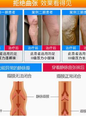 裤袜压力弹力静脉张曲女男运动中老年薄款瘦大码夏季护款护士连体