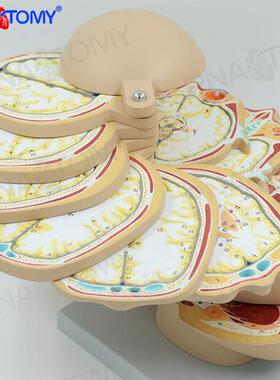 大脑头颅横切面断层模型CTMRI大脑模型放射磁共振成像教学神经科