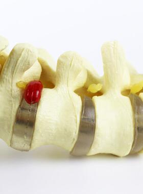 人体脊柱模型1:1正骨脊椎模型颈椎腰椎人体骨骼模型彩色脊椎模型