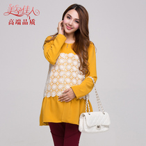 Beauty Pregnancy Canon Pregnancy Woman Dress Autumn Dress New Korea Spring And Autumn Korean Version Pregnant Woman Coat Lace splicing jacket