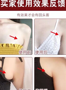 热销【三天必消】副乳消除贴疏通腋下淋巴结肿痛收巨大副乳专用散