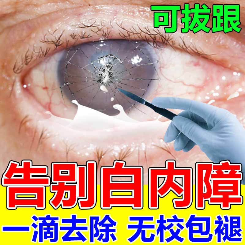 热销白内障专用眼药水老人治视力模糊看不清玻璃体浑浊滴眼液日本 - 图2