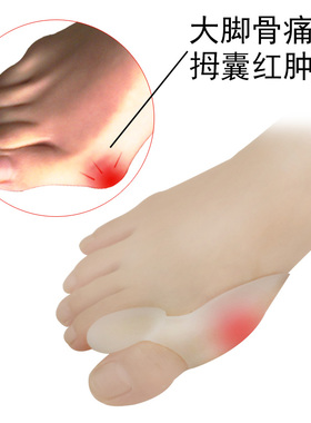 工厂销硅胶拇指外j翻矫正器日夜用大脚骨纠正脚姆凸出趾护分离理