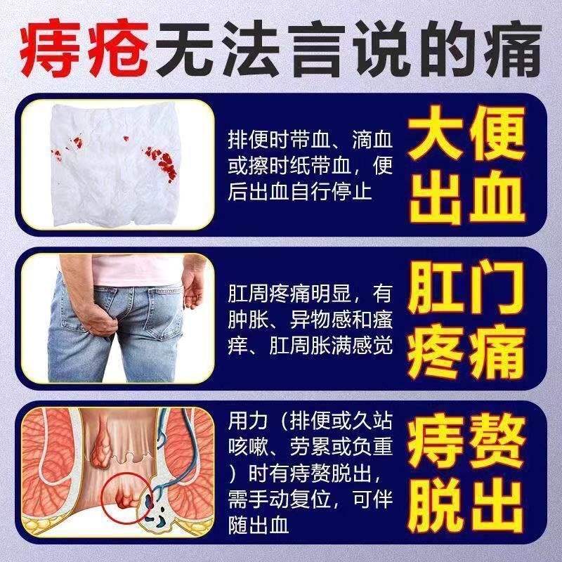 新品无花果叶子痔疮特效中药坐浴薰洗包偏方治疗肛周脓硬块肿疼消 - 图1