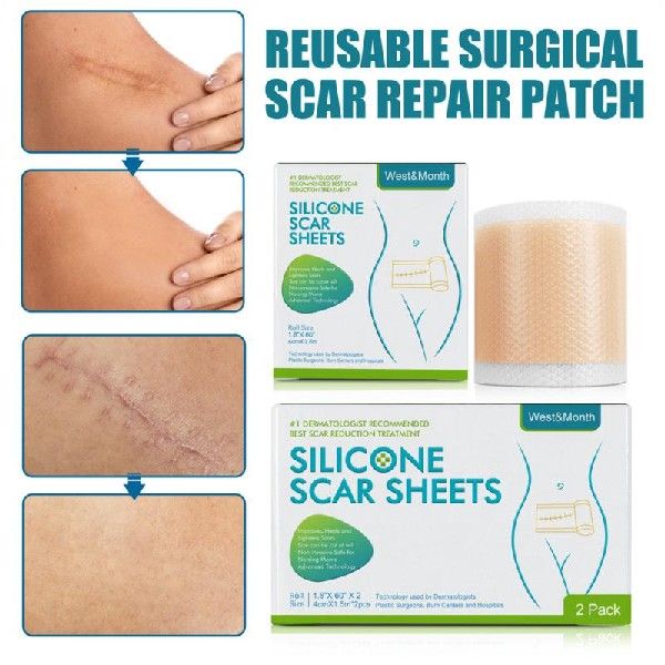 50cma Scar Remoeal Patch Svl adhesive SiliconefSc - 图1