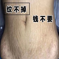 (Little Red Book Referral) The body doesnt leave a trace of the summer wearing a short dress is no longer awkward