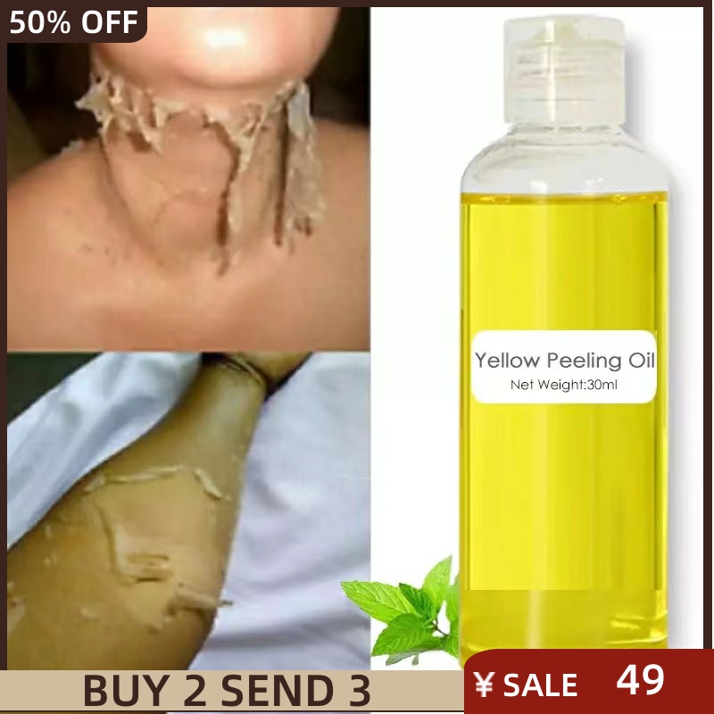 推荐Strong Yellow Peeling Oil Bleaching Dark Skin Retinol Sp - 图1