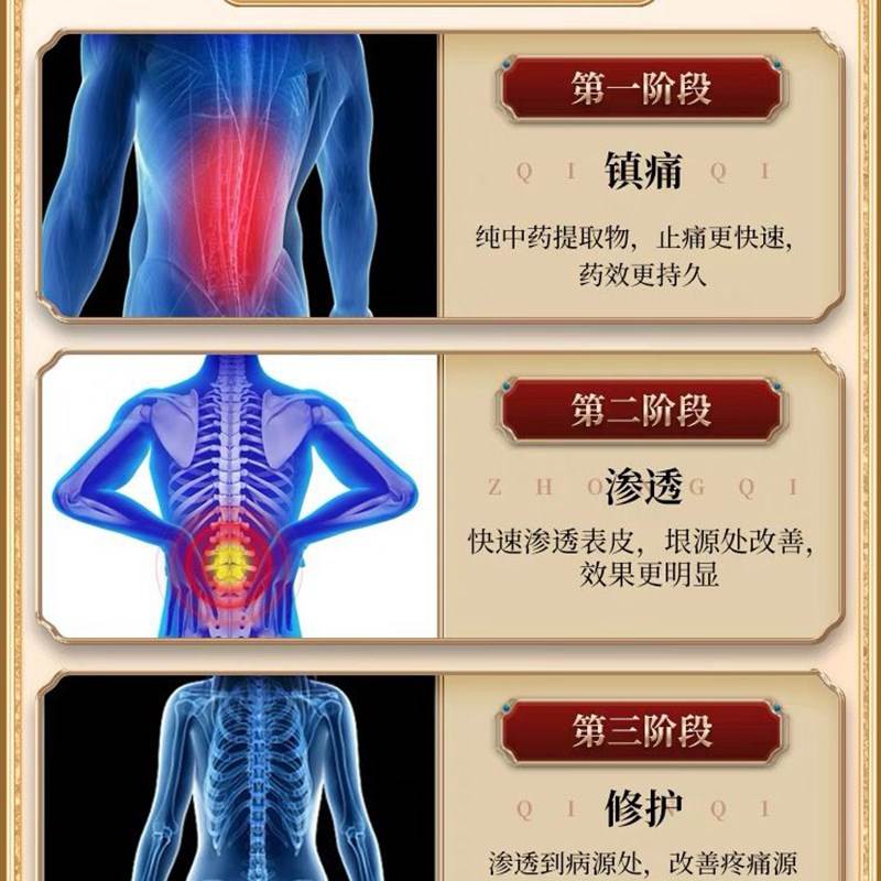 【百年秘方】腰突压迫神经疼活血止疼膏H腰脱腰麻腰疼克星腰疼贴L - 图3