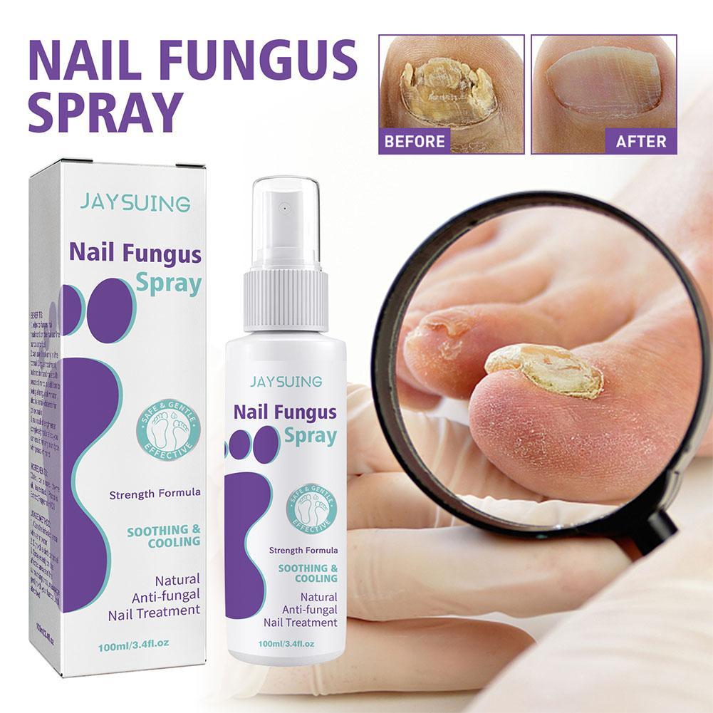 推荐100ml Effective Anti-Fungal Feet Infections Athlete Foot - 图0