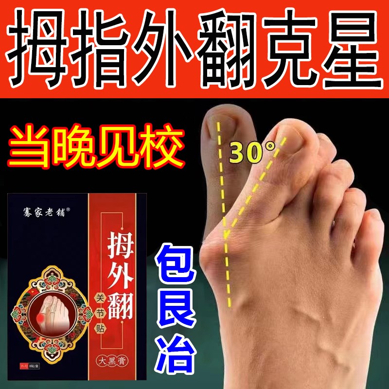 】正矫专指外翻矫正o神器女大脚骨变形脚趾关节疼痛拇用贴 - 图3