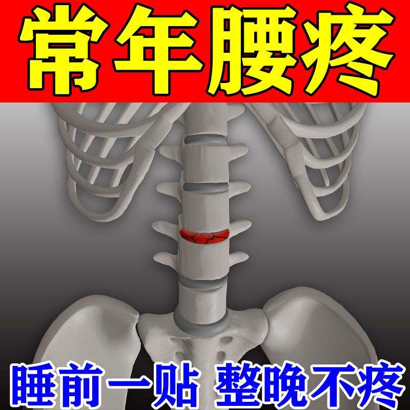 现货速发腰疼腰痛专用贴压迫神经导致腰疼腿疼脚麻弯不下腰膏贴 - 图0