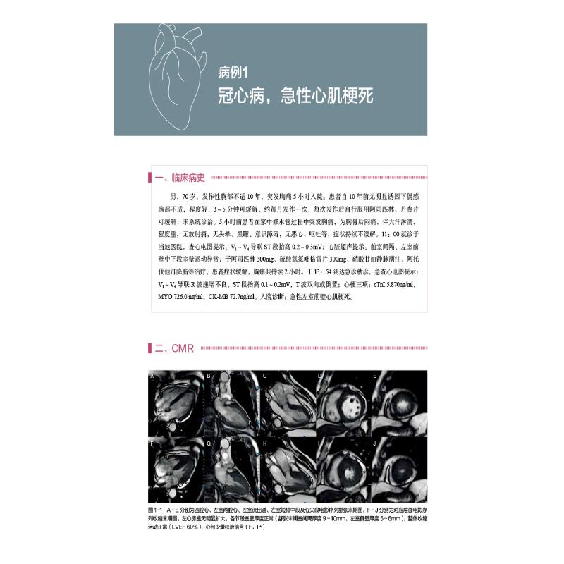 【新华文轩】心血管磁共振 病例解析与临床实践 正版书籍 新华书店旗舰店文轩官网 中国医药科技出版社