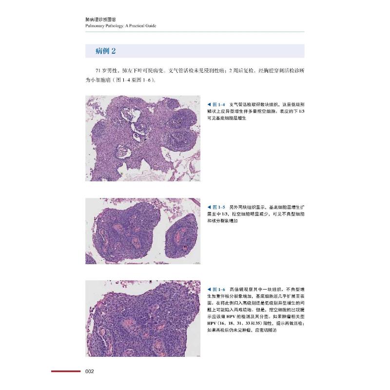 【新华文轩】肺病理诊断图谱 (奥)赫尔穆特·H.波普尔,(意)布鲁诺·穆勒 正版书籍 新华书店旗舰店文轩官网 中国科学技术出版社 - 图0