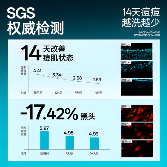 郑恺代言左颜右色男士控油祛痘洗面奶微酸氨基酸洁面乳净黑头专用
